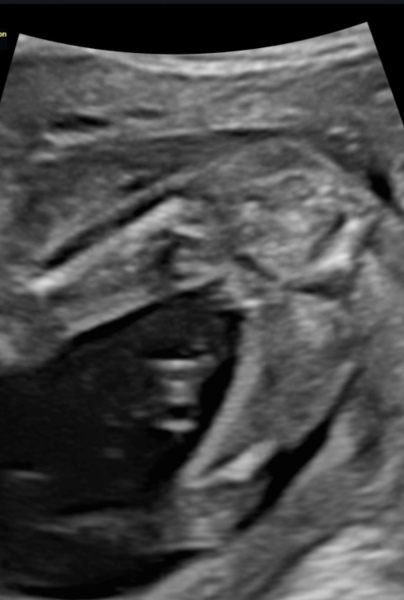 Boy or girl?