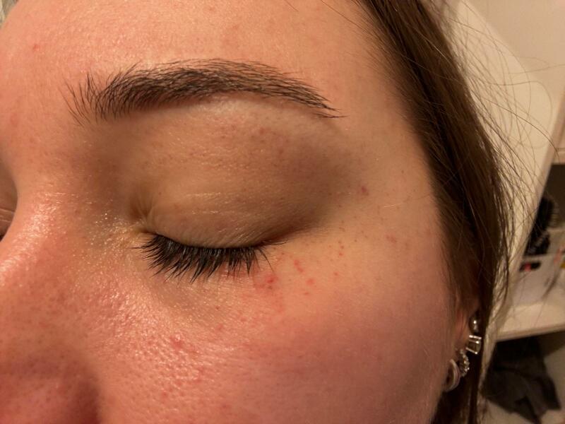 Rash & vomiting.