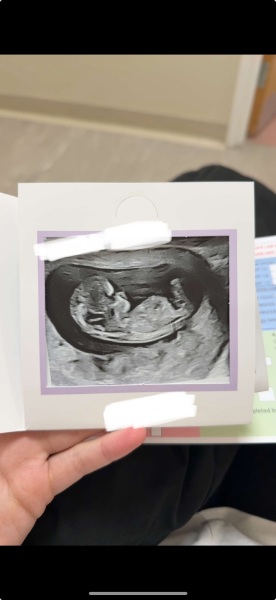 Boy or girl??