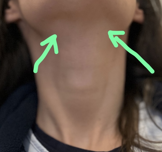 Are these lymph nodes in my neck ?