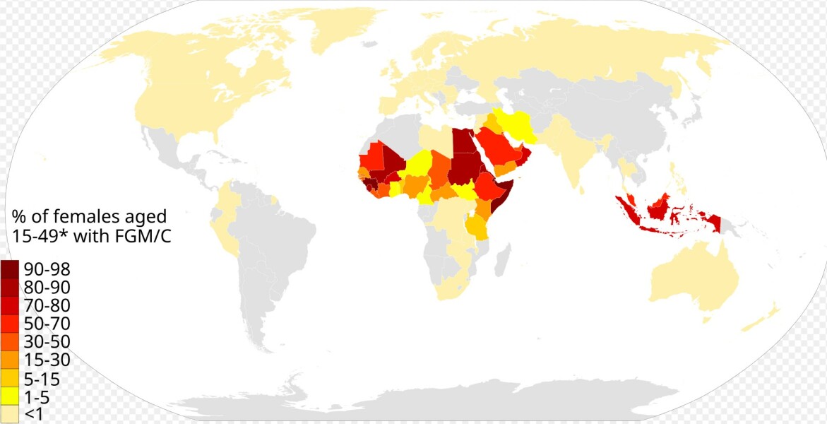 Circumcision should be banned.