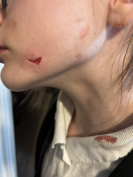 Help WARNING GRAPHIC PIC