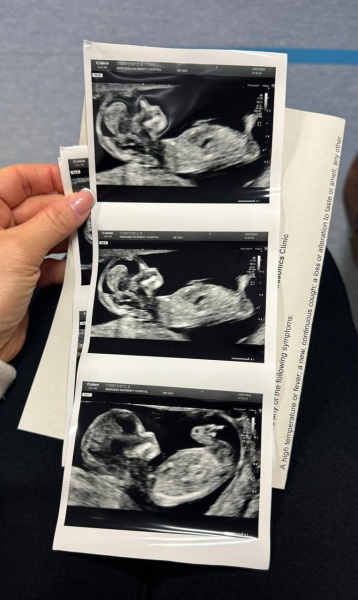 14 weeks - gender prediction?