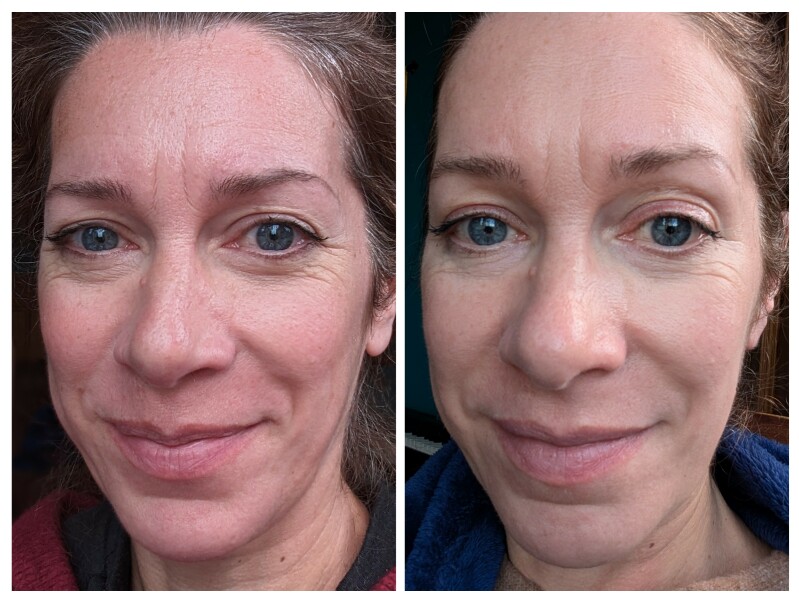 What makes your face glowing?