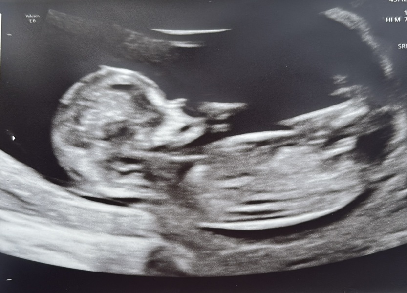 Can anyone help with gender on my scan?