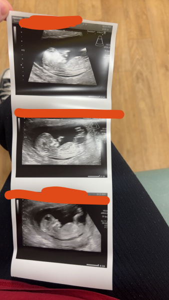 Any suggestions on my gender please