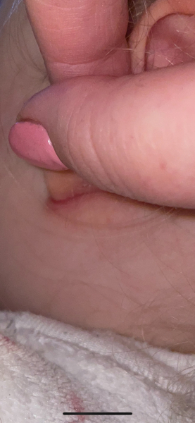 Skin issues behind toddler ear - pictures included!