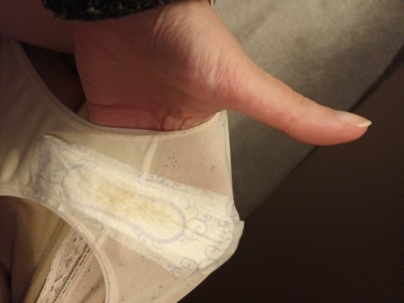 Discharge normal? WARNING PIC ATTACHED