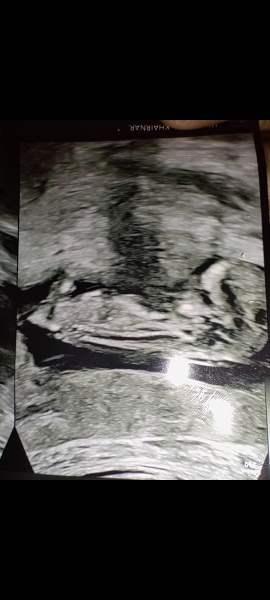 Wanted the help to find our baby gender