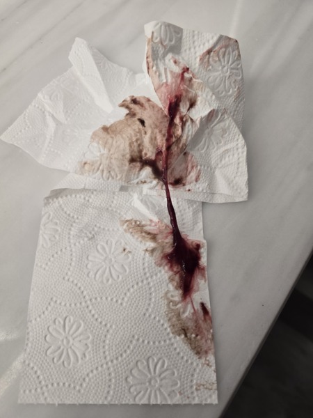 Is this bloody show? (Picture included)