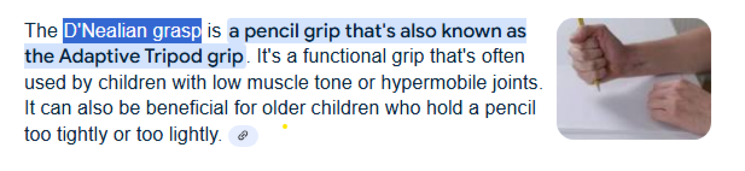 handwriting with thumb hypermobility