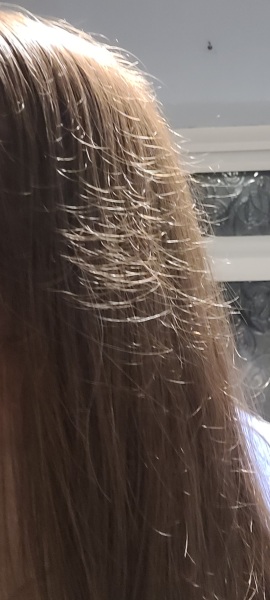 What has happened to my hair?
