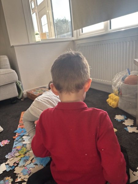 4 year old misshapen head