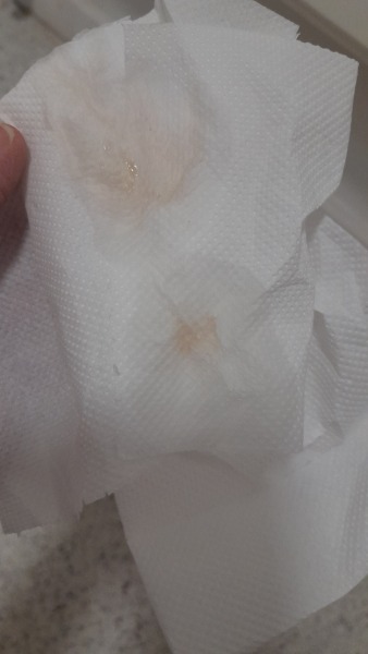 TMI photo....5 weeks pregnant pink discharge