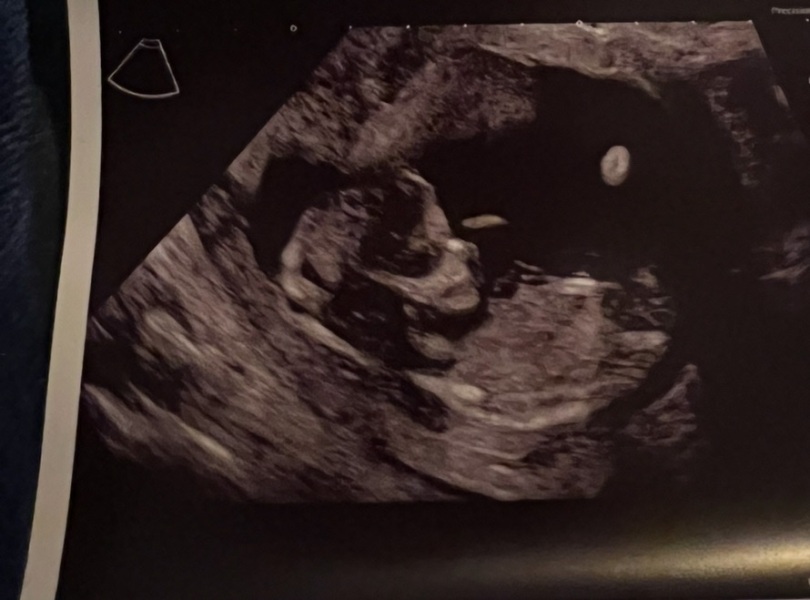 Boy or Girl?