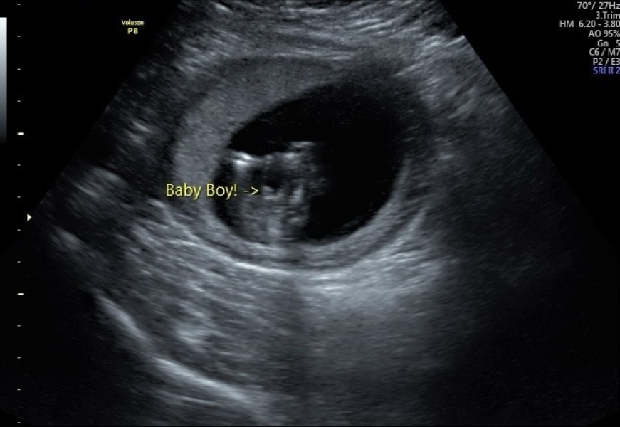 Potty shot 15 weeks