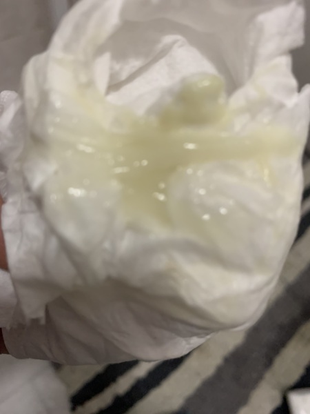 Strange discharge, and no sti's