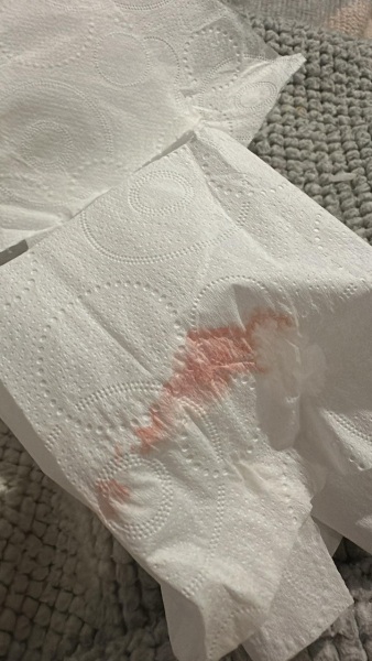 Implantation or period