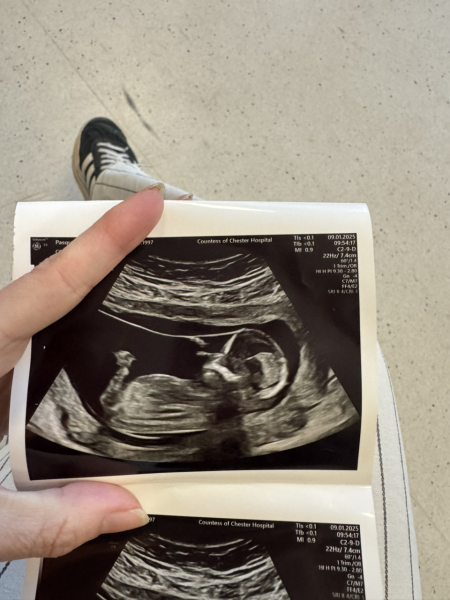 11DPO positive - but concerned