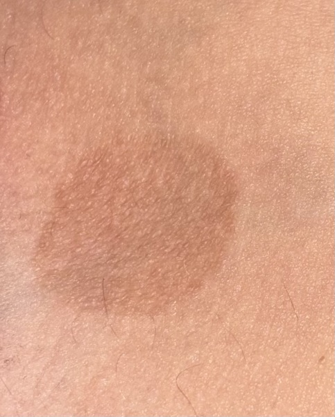 Does anyone know what these marks are?