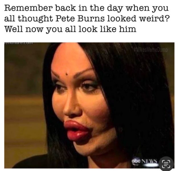 What are people doing to their faces?!