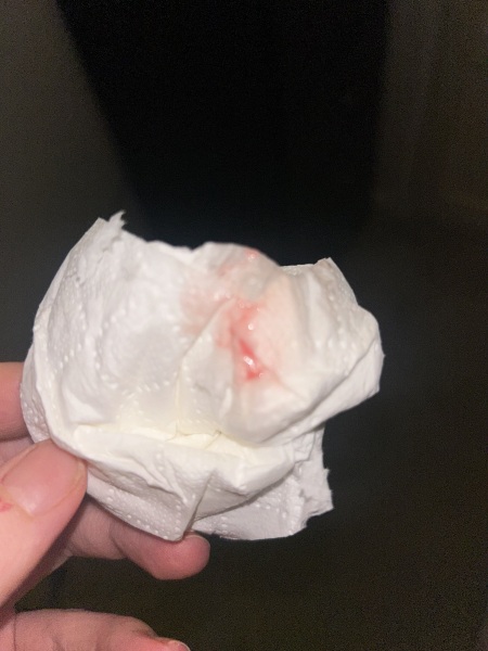 Bloody show??