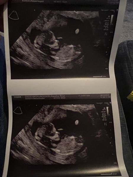 Boy or girl?