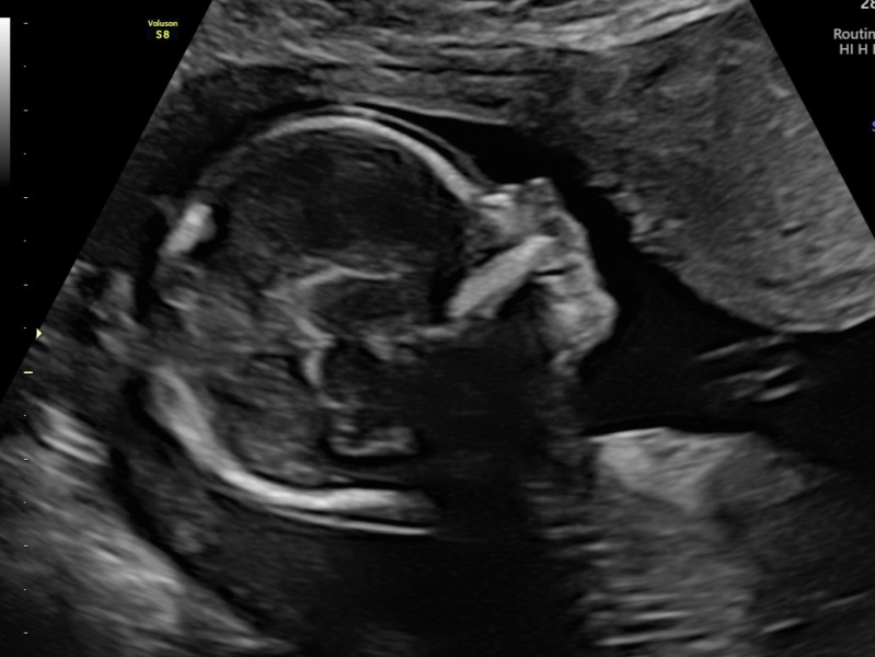 Skull theory 17 weeks just for fun 😁
