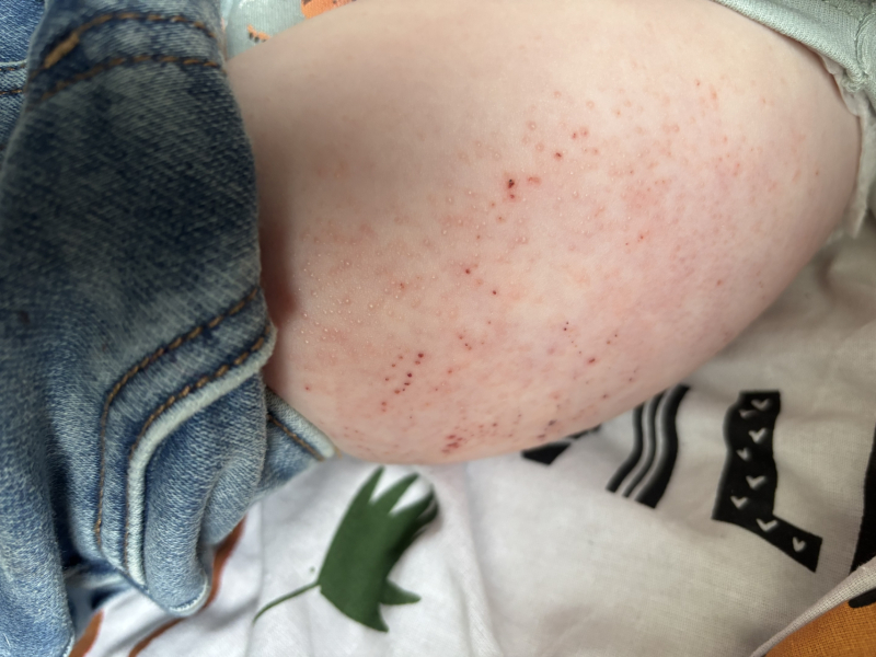 The November 2023-ish babies - the further adventures of…