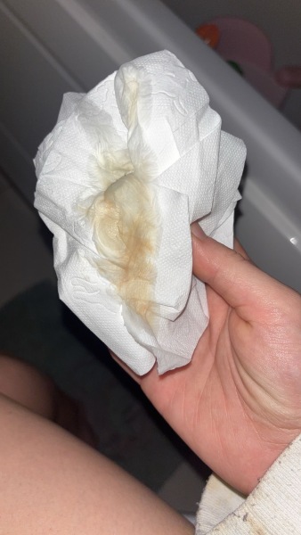 Help! TMI pics