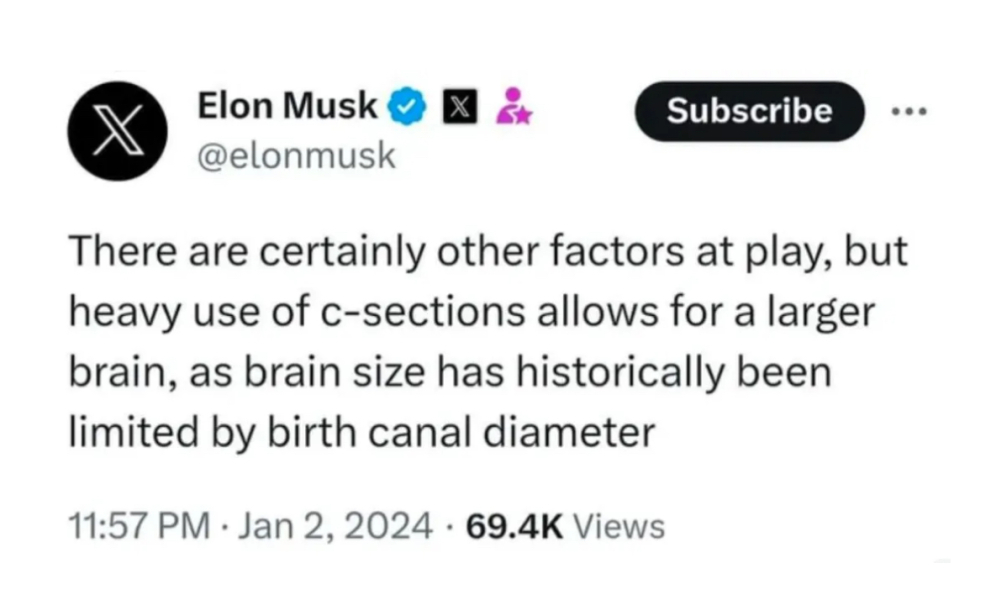 Musk claims birth by C-section leads to bigger brains - but as he constantly proves its not size that matter but intelligence