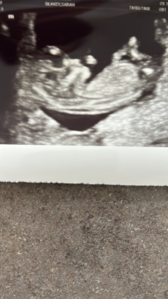 Nub - boy or girl?