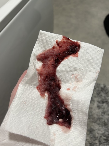 Possible miscarriage