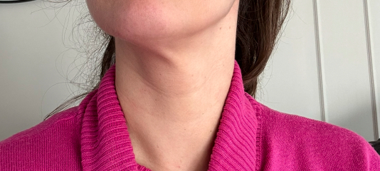 Saggy Neck Skin