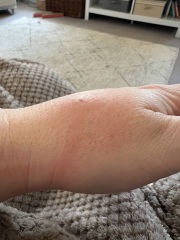 Identify my bites!