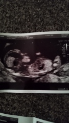 Guess the gender