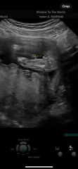 Potty shot! Boy or girl ?!