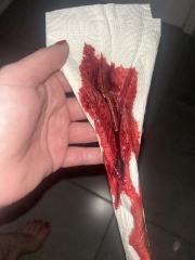 Heavy bleeding 6 weeks - pic attached