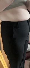Advice on tummy tuck or liposuction