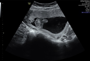 Any Sonographers out there?