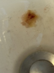 Is this popcorn or not? (Grim picture)