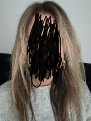 Has bleach ruined my hair ? Pics included
