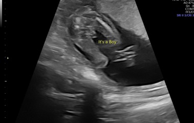 Gender scan