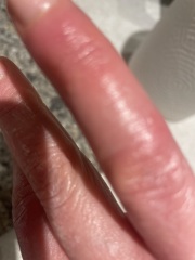 My sausage fingers need help!