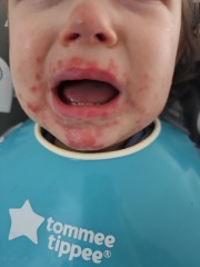 Has anyone had or seen anything like this?