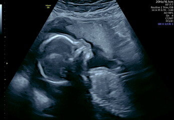 Due June 2025 pt2!