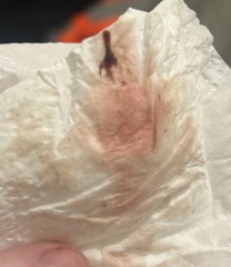 Implantation bleeding?