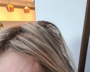 Hair snapping off, feel awful!