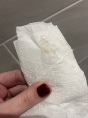 TMI image. 5 weeks 1 day am I having a miscarriage?
