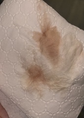 Implantation bleeding?